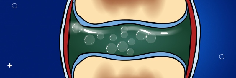 Защита суставов из морской лавки здоровья